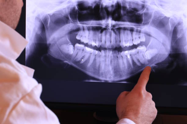 Best Broken or Cracked Tooth Emergency Dentist in Bessemer, AL